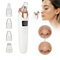 3-in-1 Electric Blackhead Remover with LED Display & Suction Levels